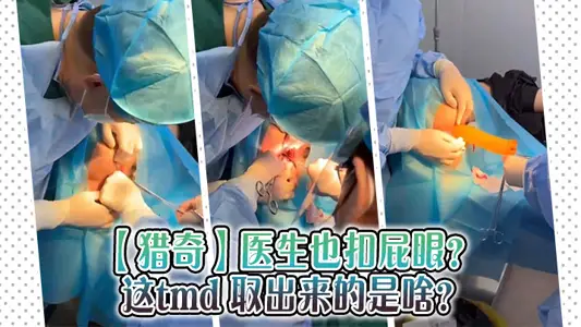 [Hunting] The doctor also buckled his asshole? What did tmd take out?