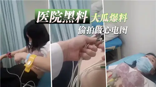 Hospital Black Big Melon Disclosures Steal Photograph for Electrocardiogram